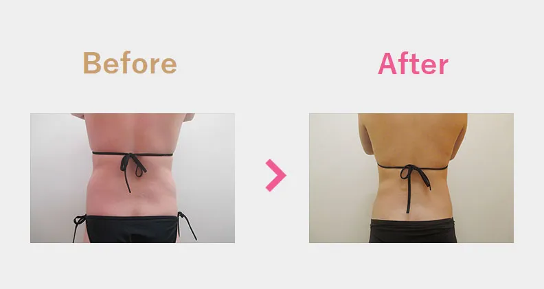 Before After（後）