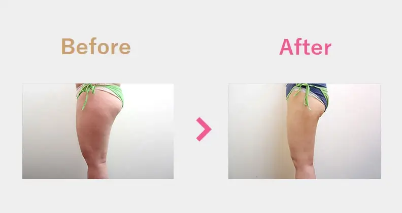 Before After（横）