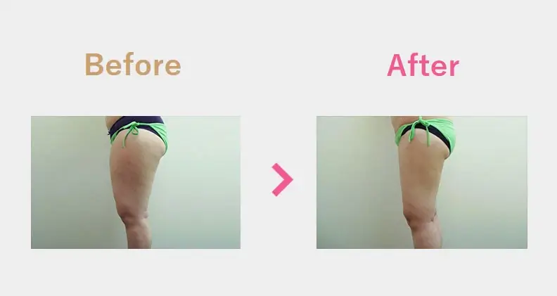 Before After（横）