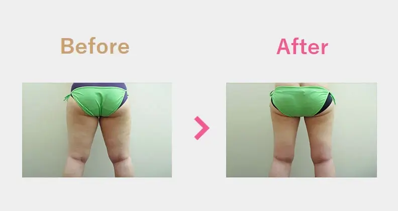 Before After（後）