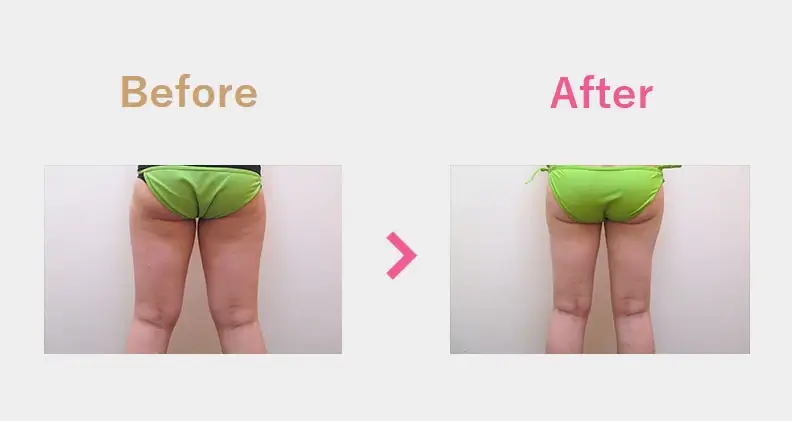 Before After（後）