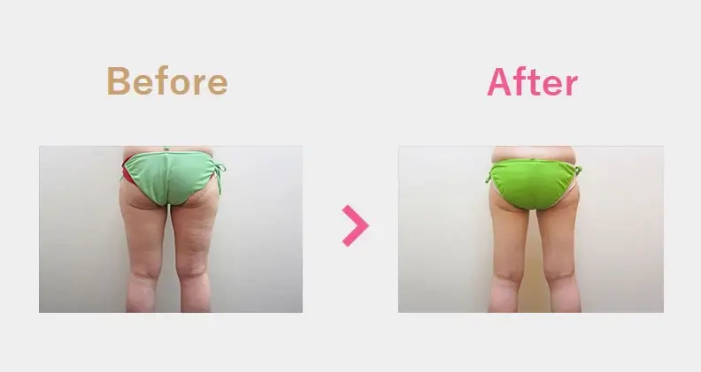 Before After（後）