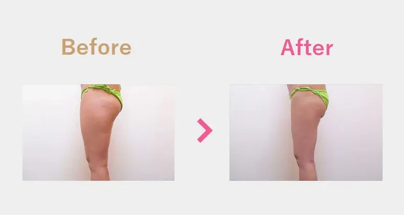 Before After（横）