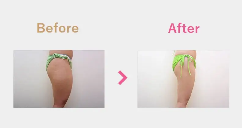 Before After（横）