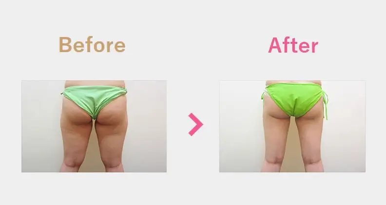 Before After（後）