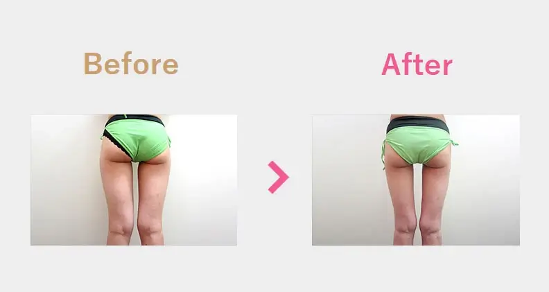Before After（後）