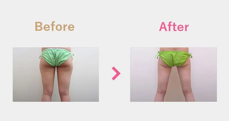 Before After（後）