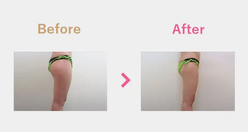 Before After（横）