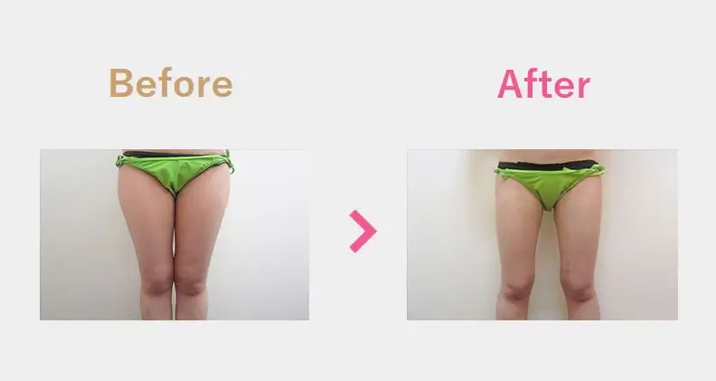 Before After（後）