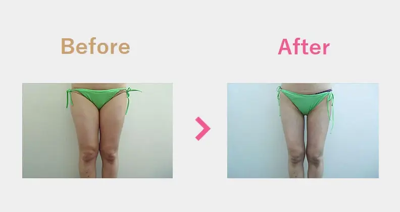 Before After（後）