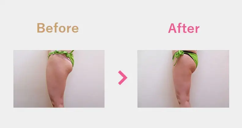 Before After（横）