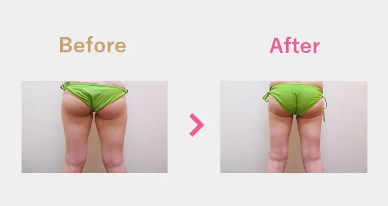 Before After（後）