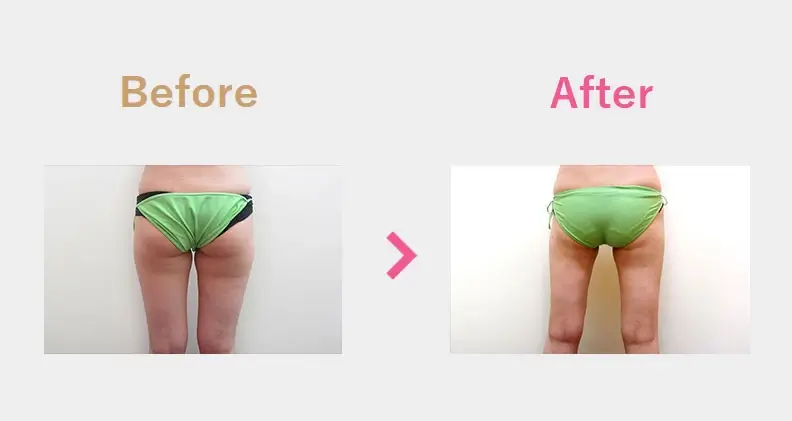 Before After（後）