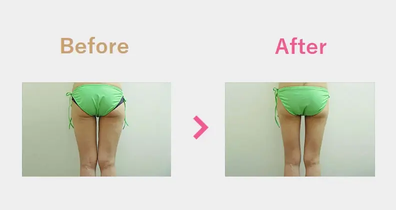 Before After（後）
