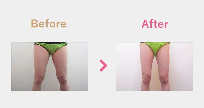 Before After（後）