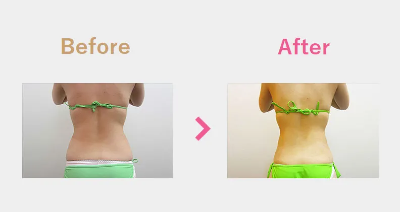 Before After（後）