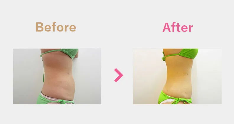 Before After（横）