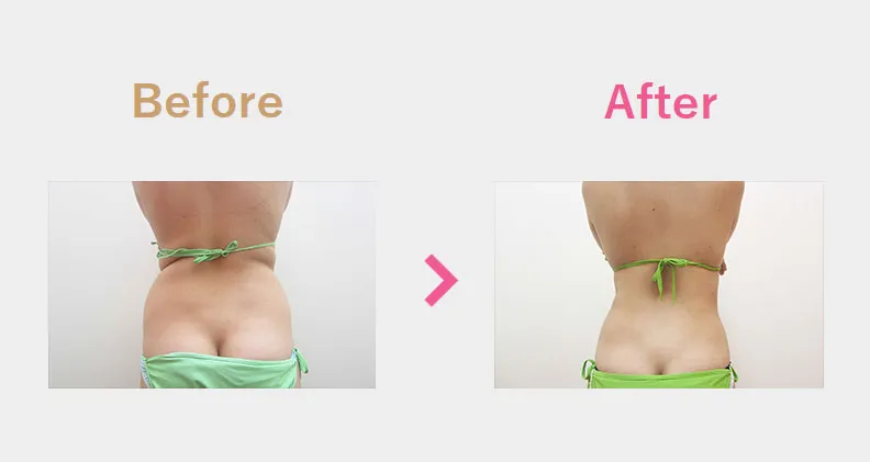 Before After（後）