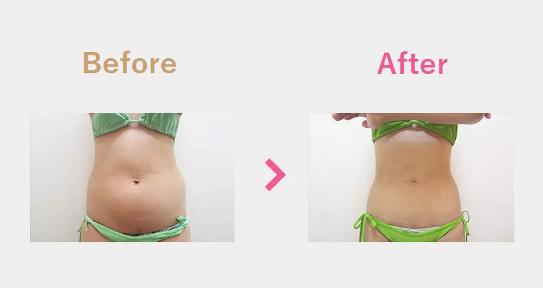 Before After（前）