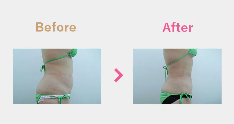 Before After（横）