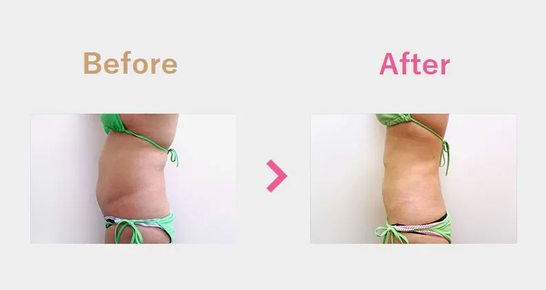 Before After（横）