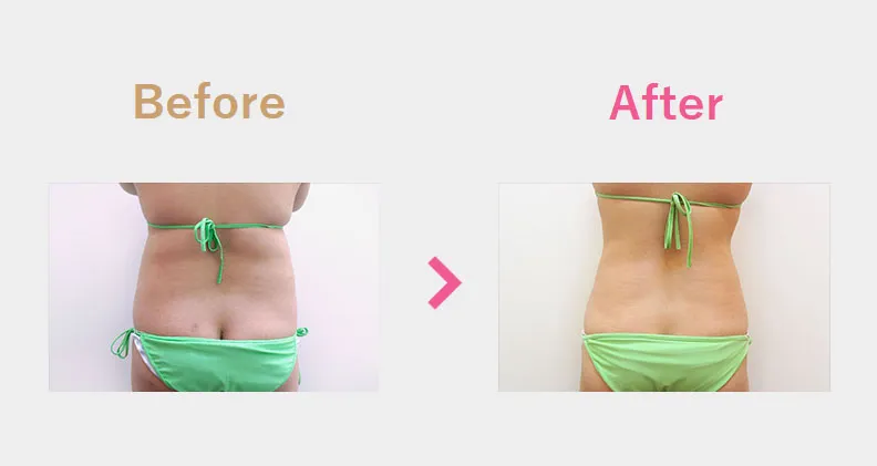 Before After（後）