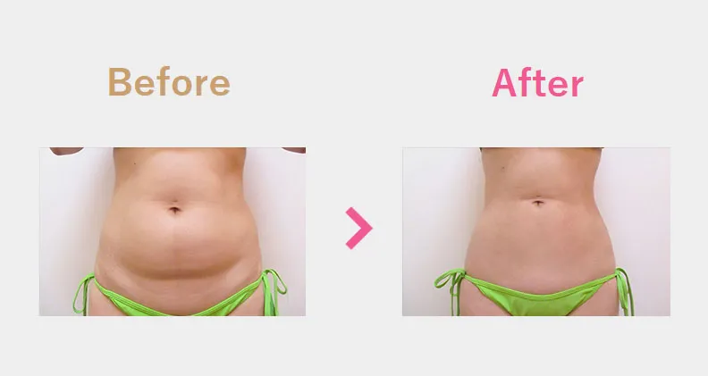 Before After（前）