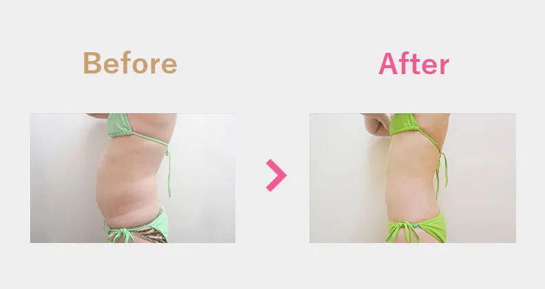Before After（横）