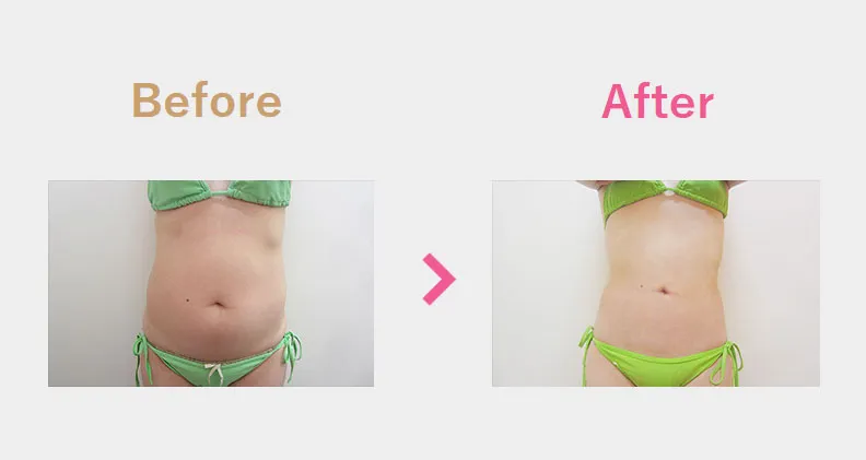 Before After（後）