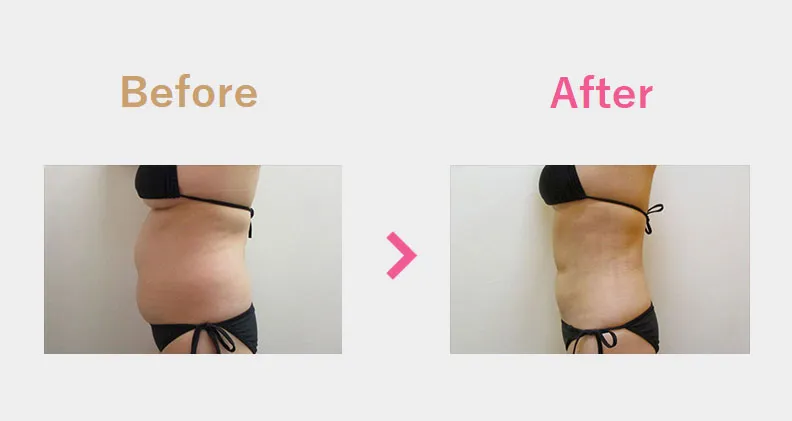 Before After（横）