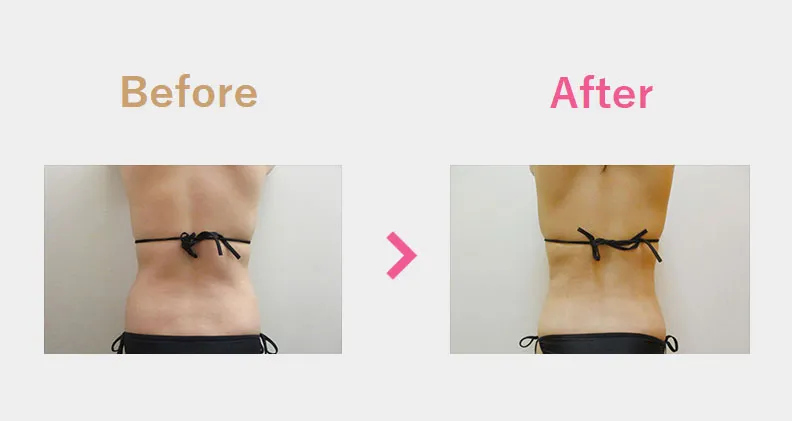 Before After（後）