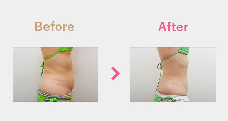 Before After（横）