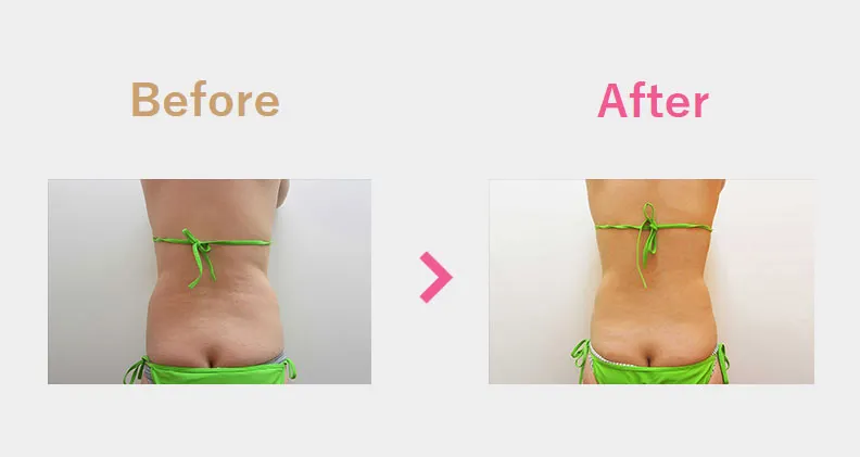 Before After（後）