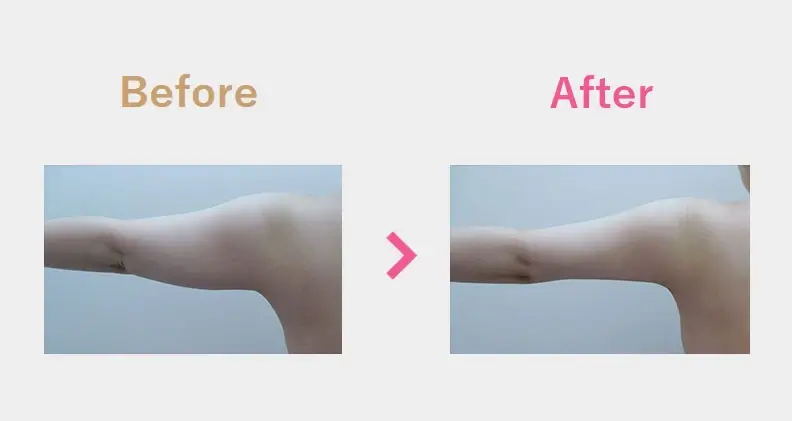 Before After（後）