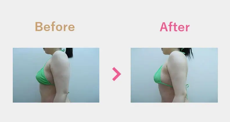 Before After（横）