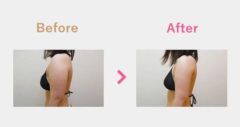 Before After（横）