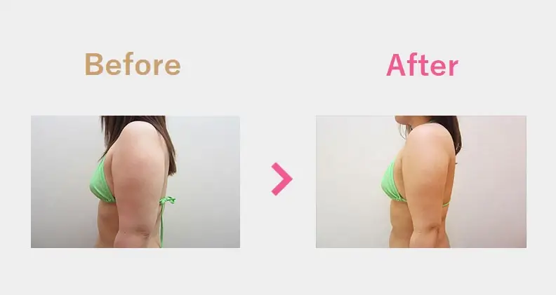 Before After（横）