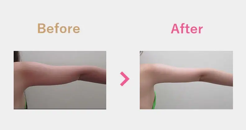 Before After（後）