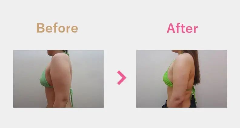 Before After（横）