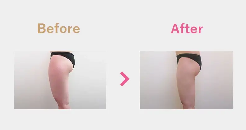 Before After（横）