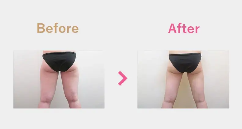 Before After（後）
