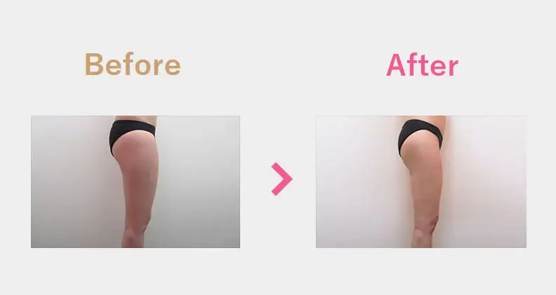 Before After（横）