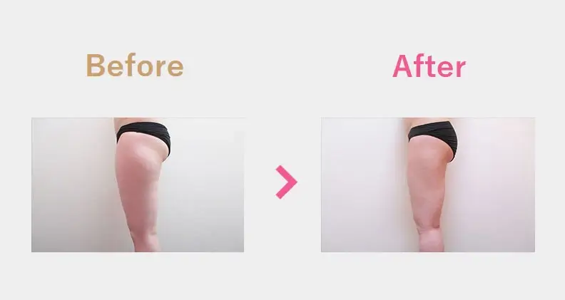 Before After（横）