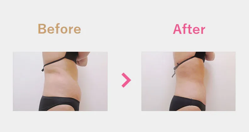 Before After（横）