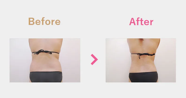 Before After（後）