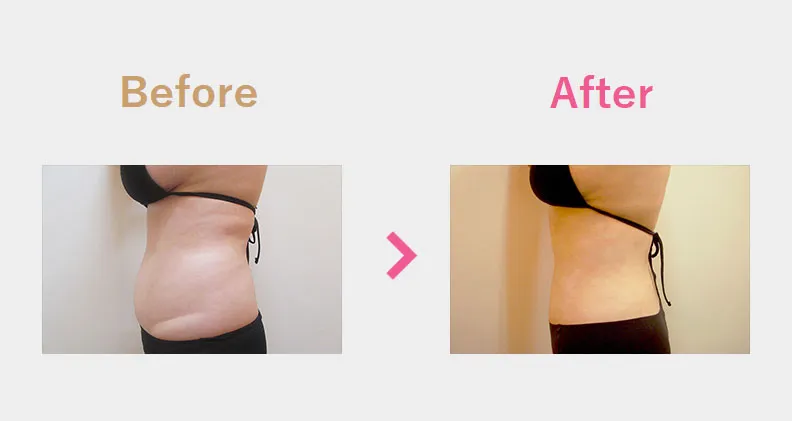 Before After（横）