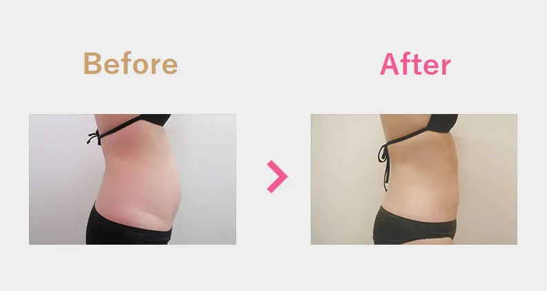 Before After（横）