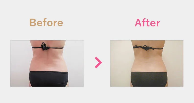Before After（後）