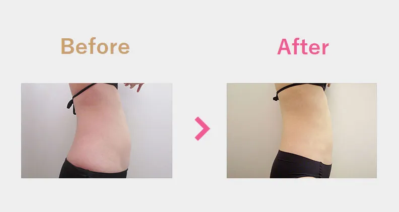 Before After（横）