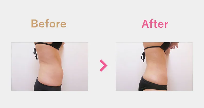 Before After（横）